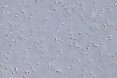 Spermatozoides de Moule (Mytilus edulis) x120